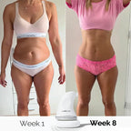 Evyra® BodySculpt Pro